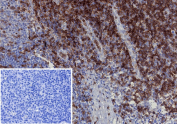 Immunohistochemistry analysis of CD2 molecule antibody (clone LFA2/13325R) in human tonsil tissue. Formalin-fixed, paraffin-embedded tonsil demonstrates strong membranous HRP-DAB brown staining in interfollicular T lymphocytes, consistent with CD2 expression on mature T cells. Germinal center B cells show minimal to no staining, while hematoxylin counterstain highlights overall lymphoid architecture. The inset shows PBS used in place of primary antibody as a negative control, confirming absence of non-specific secondary antibody binding. Heat-induced epitope retrieval was performed by heating tissue sections in 10 mM Tris with 1 mM EDTA, pH 9.0, for 45 minutes at 95oC followed by cooling at room temperature for 20 minutes prior to staining.