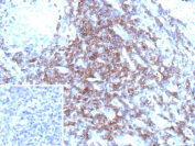 Immunohistochemistry analysis of CD3D/CD3 delta subunit antibody (clone CD3D/13089R) in human tonsil tissue. Formalin-fixed, paraffin-embedded tonsil demonstrates strong membranous HRP-DAB brown staining in interfollicular T lymphocytes, consistent with CD3 complex expression in mature T cells. Germinal center B cell areas show minimal staining, highlighting the expected T cell-restricted distribution pattern. Hematoxylin counterstain delineates nuclear morphology and tonsillar architecture. The inset shows PBS used in place of primary antibody as a negative control, confirming absence of non-specific secondary antibody binding. Heat-induced epitope retrieval was performed by heating tissue sections in 10 mM Tris with 1 mM EDTA, pH 9.0, for 45 minutes at 95oC followed by cooling at room temperature for 20 minutes prior to staining.