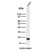 Western blot analysis of CD3D/CD3 delta subunit antibody (clone CD3D/13089R) in human Jurkat cell lysate. A distinct band is observed at approximately 20-25 kDa, consistent with the predicted molecular weight of the CD3 delta subunit. The detected signal corresponds to endogenous CD3 delta expressed in T lymphoblastic Jurkat cells. Molecular weight markers are indicated in kDa on the left.