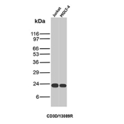 Western blot analysis of CD3D/CD3 delta subunit antibody (clone CD3D/13089R) in human Jurkat and MOLT-4 cell lysates. A single band is observed at approximately 20-25 kDa in both lanes, consistent with the predicted molecular weight of the CD3 delta subunit. Comparable band intensity in Jurkat and MOLT-4 cells reflects endogenous expression of CD3 delta in T lymphoblastic cell lines. Molecular weight markers are indicated in kDa on the left.
