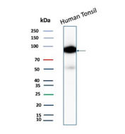 Western blot analysis of CD19/CD19 molecule antibody in human tonsil tissue lysate. A strong band is detected at approximately 95 kDa, consistent with the predicted molecular weight of CD19 (Cluster of Differentiation 19), a glycosylated B cell surface receptor. The observed band migrates slightly above the core protein size, which is expected due to N-linked glycosylation of CD19. Blot was probed with CD19/CD19 molecule antibody (clone CD19/4260R).