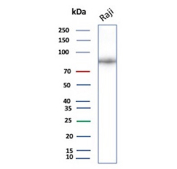 Western blot analysis of CD19/CD19 molecule antibody in human Raji cell lysate. A distinct band is detected at approximately 90-95 kDa, consistent with the predicted molecular weight of CD19 (Cluster of Differentiation 19). The slightly diffuse migration pattern is expected, as CD19 is a glycosylated B cell surface receptor and N-linked glycosylation contributes to an increased apparent molecular weight on SDS-PAGE. Blot was probed with CD19/CD19 molecule antibody (clone CD19/4260R7).