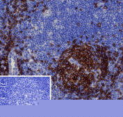 Immunohistochemistry analysis of CD19/CD19 molecule antibody in human tonsil tissue. FFPE human tonsil demonstrates strong membranous HRP-DAB brown staining in B lymphocytes within germinal centers, consistent with CD19 (Cluster of Differentiation 19) expression on mature B cells, while surrounding interfollicular T cell-rich areas show minimal staining. The inset image using PBS in place of primary antibody as a secondary-only negative control shows absence of specific signal. Antigen retrieval was performed by heating tissue sections in 10mM Tris with 1mM EDTA, pH 9.0, at 95oC for 45 minutes followed by cooling at room temperature for 20 minutes prior to incubation with CD19/CD19 molecule antibody (clone CD19/4260R).