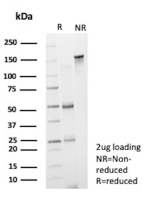 SDS-PAGE analysis of B lymphocyte antigen CD19 Antibody under reducing (R) and non-reducing (NR) conditions. Purified B lymphocyte antigen CD19 Antibody (clone CD19/13031R) was loaded at 2 ug per lane. Under non-reducing conditions, the antibody migrates as an intact IgG at approximately 150 kDa. Under reducing conditions, distinct bands corresponding to the heavy chain at approximately 50 kDa and light chain at approximately 25 kDa are observed, confirming expected antibody structure, purity, and integrity.