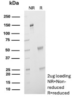 SDS-PAGE Analysis of Purified Synaptic Vesicle Protein 2 (SV2) Recombinant Mouse Monoclonal Antibody (r15E11). Confirmation of Purity and Integrity of Antibody.