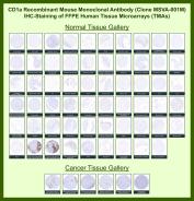 CD1A Antibody for IHC Tissue Microarray (TMA). Immunohistochemistry analysis of CD1a molecule / CD1A in formalin-fixed paraffin-embedded human normal and cancer tissue microarrays using recombinant mouse monoclonal CD1A antibody clone MSVA-001M. Tissue microarray (TMA) staining with HRP-DAB brown chromogen demonstrates membranous and cytoplasmic localization in dendritic cell populations, with strong signal observed in Langerhans cells within epithelial tissues, while most non-immune cell types remain largely negative. Within tumor tissue microarrays, positive staining highlights tissue-resident antigen-presenting cells and infiltrating dendritic cells, supporting evaluation of immune cell distribution and microenvironment composition. Evaluation across large TMA panels enables direct comparison of CD1A expression across diverse tissue types under standardized conditions. The observed staining patterns align with reported CD1A expression profiles in the Human Protein Atlas.
