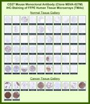 CD27 Antibody for IHC Tissue Microarray (TMA). Immunohistochemistry analysis of CD27 molecule CD27, also known as TNFRSF7, in formalin-fixed paraffin-embedded human normal and cancer tissue microarrays using recombinant mouse monoclonal CD27 antibody clone MSVA-027M. Tissue microarray (TMA) staining with HRP-DAB brown chromogen demonstrates strong membranous localization in lymphocyte-rich tissues including tonsil, lymph node, spleen, and thymus, highlighting activated and memory T and B lymphocyte populations, while most non-lymphoid tissues remain largely negative. Within tumor tissue microarrays, CD27-positive tumor-infiltrating lymphocytes are detected across multiple malignancies, with strong and diffuse staining observed in lymphoid neoplasms consistent with B cell lineage origin. Evaluation across large TMA panels enables direct comparison of CD27 expression across diverse tissue types under standardized conditions. The observed staining patterns align with reported CD27 expression profiles in the Human Protein Atlas, supporting its use as a lymphocyte marker and indicator of the immune microenvironment.