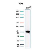 Western blot analysis of Folate receptor alpha expression in human brain tissue. Lysates from human brain was analyzed by western blot using recombinant Folate receptor 1 antibody (clone FOLR1/12903R). A single immunoreactive band is detected in human brain lysate. Although the predicted molecular weight of Folate receptor alpha is approximately 30 kDa based on sequence analysis, the protein is extensively glycosylated, resulting in a higher apparent molecular weight on SDS-PAGE.
