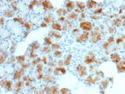 Immunohistochemistry of Folate receptor alpha in human adrenal gland tissue. Formalin-fixed, paraffin-embedded human adrenal gland tissue stained with recombinant Folate receptor 1 antibody (clone FOLR1/12903R) shows cytoplasmic punctate staining in adrenal cortical cells, with minimal signal in surrounding stromal regions. Inset shows negative control with PBS substituted for the primary antibody. Antigen retrieval was performed by heating tissue sections in 10 mM Tris with 1 mM EDTA, pH 9.0, at 95oC for 45 minutes, followed by cooling at room temperature for 20 minutes.