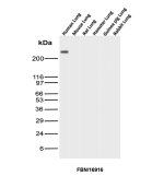 Fibronectin 1 Antibody Lung WB. Western blot analysis was performed using Fibronectin 1 Antibody (clone FBN/16916R). Lane 1: human lung tissue lysate; lane 2: mouse lung tissue lysate; lane 3: rat lung tissue lysate; lane 4: hamster lung tissue lysate; lane 5: guinea pig lung tissue lysate; lane 6: rabbit lung tissue lysate. A strong immunoreactive band is detected at approximately 220â250 kDa exclusively in the human lung lysate, while no corresponding bands are observed in the non-human tissue lysates. These results demonstrate the human specificity of this Human Fibronectin Antibody for Western blot detection of Fibronectin 1.