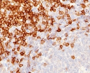 CD5 Antibody for IHC. Immunohistochemistry analysis of CD5 antibody staining in FFPE human tonsil tissue using an inflammatory response regulation marker antibody, clone CLDA5-1. Strong membranous staining is observed in interfollicular T lymphocytes with dense labeling of T cell zones surrounding germinal centers, while follicular B cell regions remain largely negative. The staining pattern highlights normal tonsillar architecture and reflects the role of CD5 in regulating immune activation and inflammatory signaling within lymphoid tissue. Heat-induced epitope retrieval was performed using pH 9 Tris-EDTA buffer for 10-20 minutes followed by cooling at room temperature prior to antibody incubation.