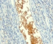 Formalin-fixed, paraffin-embedded human tonsil stained with AMPD3 antibody (clone ETAD3-1).