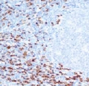 CD8A Antibody Tonsil Tissue IHC. Immunohistochemistry analysis of CD8 alpha (CD8A) in FFPE human tonsil tissue shows membranous staining of cytotoxic T lymphocytes within lymphoid regions, consistent with CD8-positive cells participating in immune responses associated with checkpoint-regulated T cell activity and supporting detection of this immune checkpoint response marker in secondary lymphoid tissue (clone CLDA8a-1). Heat-induced epitope retrieval was performed in pH 9 10 mM Tris with 1 mM EDTA for 10-20 minutes followed by cooling at room temperature.