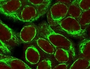 Cytokeratin 8 Antibody HeLa Cell IF. Immunofluorescent staining of permeabilized human HeLa cells with Cytokeratin 8 antibody (clone CYKN8-1, green) and Reddot nuclear stain (red).