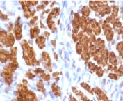 Calponin Antibody Rat Uterus Immunohistochemistry. IHC testing of FFPE rat uterus and Calponin antibody (clone CLPN5-1). Staining of formalin-fixed tissues requires boiling tissue sections in 10mM Tris with 1mM EDTA, pH 9, for 10-20 min followed by cooling at RT for 20 min.