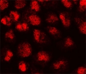Immunofluorescent staining of human HeLa cells with p21 antibody (clone WAF21-1).