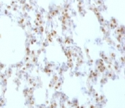 TTF-1 Antibody Rat Lung IHC. Immunohistochemistry of TTF-1 Antibody / Pulmonary Epithelial Cell Marker Antibody in rat lung tissue. FFPE rat lung tissue stained using TTF-1 Antibody / Pulmonary Epithelial Cell Marker Antibody. The mouse monoclonal clone HBNK2-1 antibody demonstrates strong nuclear staining in pulmonary epithelial cells of the respiratory epithelium, including alveolar epithelial cells consistent with type II pneumocytes. Nuclear immunoreactivity for Thyroid transcription factor 1 (NKX2-1) highlights pulmonary epithelial lineage and clearly identifies epithelial cells of the respiratory epithelium within lung tissue. This staining pattern reflects the well-established role of TTF-1 as a pulmonary epithelial cell marker and alveolar epithelial lineage marker used in immunohistochemistry to study respiratory epithelium and pulmonary epithelial differentiation in lung tissue. Required HIER: boil FFPE tissue sections in pH6 10mM citrate buffer for 10-20 minutes followed by cooling at RT for 20 minutes.