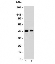 EMI1 Antibody HeLa and 293 WB. Western blot analysis of human 1) HeLa and 2) 293 cell lysates using EMI1 Antibody / Mitotic Progression Regulator Antibody demonstrates distinct bands at approximately 45-50 kDa, consistent with the predicted molecular weights of Early mitotic inhibitor 1 / FBXO5 isoforms 1 and 2. The observed expression pattern aligns with the role of EMI1 as a regulator of APC/C-associated signaling, mitotic progression, and proliferative cell cycle control.
