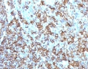 HLA-DRB1 Antibody Mouse Monoclonal MHDRb2 immunohistochemistry analysis of human tissue. IHC staining of formalin-fixed, paraffin-embedded human tonsil using HLA-DRB1 Antibody Mouse Monoclonal MHDRb2 demonstrates HRP-DAB brown membranous staining in numerous antigen-presenting immune cells within lymphoid tissue. The staining pattern highlights B lymphocytes and other immune cell populations consistent with expression of the HLA-DR beta chain / HLA-DRB1 in professional antigen-presenting cells. Heat-induced epitope retrieval was performed by boiling tissue sections in pH 9 10 mM Tris with 1 mM EDTA for 10-20 min followed by cooling at room temperature prior to antibody incubation.