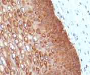 Immunohistochemistry of Keratin 14 / KRT14 in human cervix tissue. Formalin-fixed, paraffin-embedded human cervix tissue stained with Keratin 14/KRT14 antibody (clone CTKN14-1) shows strong cytoplasmic staining in basal and parabasal squamous epithelial cells, with reduced staining in more superficial differentiated layers and minimal signal in adjacent stromal tissue. Antigen retrieval was performed by boiling tissue sections in 10 mM Tris with 1 mM EDTA, pH 9.0, for 10-20 minutes, followed by cooling at room temperature for 20 minutes.