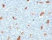 IHC testing of FFPE human tonsil with S100A9 antibody (clone PS1A9-1). Staining of formalin-fixed tissues requires boiling tissue sections in pH 9 10mM Tris with 1mM EDTA for 10-20 min followed by cooling at RT for 20 min.