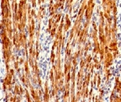 IHC testing of formalin-fixed, paraffin-embedded human uterus stained with Calponin antibody (clone RMCN1-1). HIER: steam sections in 10mM Tris with 1mM EDTA, pH 9.0, for 10-20 min.