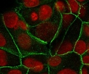 E-cadherin Antibody for IF. Immunofluorescence analysis of Cadherin 1 / CDH1 expression in human MCF7 cells using clone ECD1-2 antibody (green), showing membrane-associated staining with areas of variable continuity at cell-cell junctions, with Reddot nuclear stain (red). Signal highlights junctional organization and localized changes in cell-cell adhesion consistent with junction remodeling.