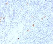 IHC testing of human tonsil with IgG4/Immunoglobulin G4 antibody (clone IHCG4-1). Staining of FFPE tissue is enhanced by boiling sections in 10mM Tris with 1mM EDTA, pH9 for 10-20 min followed by cooling at RT for 20 min.