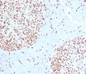 TOP2A Antibody / DNA Replication Enzyme Antibody (clone TPM2A-1). Immunohistochemistry analysis of FFPE human tonsil tissue demonstrates strong nuclear staining consistent with expression of DNA Topoisomerase II alpha, a DNA replication enzyme required for resolving topological stress during DNA synthesis. Nuclear immunoreactivity is concentrated within germinal center lymphocytes, reflecting the high DNA replication activity of these rapidly proliferating immune cells. The DNA Replication Enzyme Antibody highlights cells undergoing active DNA synthesis where replication forks generate torsional strain that must be resolved by DNA Topoisomerase II alpha. Surrounding mantle zone lymphocytes show comparatively reduced staining, consistent with lower DNA replication activity in these cells.