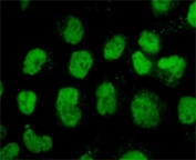 TOP2A Antibody / DNA Replication Enzyme Antibody (clone TPM2A-1). Immunofluorescence analysis of PFA-fixed human HeLa cells demonstrates strong nuclear staining of DNA Topoisomerase II alpha, a DNA replication enzyme required for resolving torsional stress generated during DNA synthesis. Green fluorescence highlights nuclear localization of TOP2A in proliferating cells where active DNA replication and replication fork progression are occurring. As a DNA Replication Enzyme Antibody, clone TPM2A-1 enables visualization of the nuclear enzyme responsible for maintaining DNA topology during genome duplication, supporting studies of replication dynamics and DNA synthesis in dividing cells.