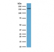 TOP2A Antibody / DNA Replication Enzyme Antibody (clone TPM2A-1). Western blot analysis of human HeLa cell lysate following SDS-PAGE separation and membrane transfer demonstrates detection of DNA Topoisomerase II alpha. A band is detected at approximately 170-180 kDa, consistent with the predicted molecular weight of DNA Topoisomerase II alpha / TOP2A (~174 kDa). The detected band corresponds to the DNA replication enzyme responsible for resolving topological stress generated during DNA synthesis and replication fork progression. Detection of the denatured TOP2A protein band supports the use of this DNA Replication Enzyme Antibody for western blot analysis of DNA Topoisomerase II alpha in human cell lysates.