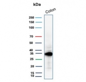Calponin Antibody Colon WB. Western blot analysis of human colon tissue lysate using Calponin antibody. The recombinant rabbit monoclonal antibody clone CNN1/1408R was used for this assay. A band is detected at approximately 34 kDa, consistent with the predicted molecular weight of Calponin 1 / CNN1. Signal in colon tissue reflects expression in smooth muscle components of the intestinal wall, supporting its role as an actin-associated cytoskeletal protein.