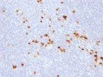 Human IgG Antibody IG507R Human Tonsil IHC. Immunohistochemistry was performed on FFPE human tonsil tissue using Human IgG Antibody IG507R. Heat-induced epitope retrieval was performed by steaming tissue sections in 10 mM citrate buffer (pH 6.0) for 10-20 minutes prior to staining. Strong cytoplasmic staining is observed in scattered plasma cells throughout the tonsillar lymphoid tissue, while the surrounding lymphocytes exhibit minimal background staining. This staining pattern is consistent with the expected expression of human IgG in antibody-producing plasma cells. These results demonstrate that Human IgG Antibody IG507R is suitable for immunohistochemical detection of human IgG in formalin-fixed, paraffin-embedded human tissues.