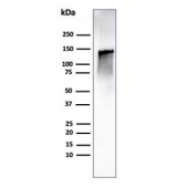 Caldesmon Antibody / CALD1 Cell Motility and Migration Regulatory Protein Antibody. Western blot analysis of Caldesmon (CALD1) in human ovary tissue lysate. Lane 1: human ovary tissue lysate. A band is detected at approximately 120-150 kDa, consistent with the predicted molecular weight of Caldesmon / CALD1 and representing the high molecular weight h-caldesmon isoform associated with contractile cell populations. Additional lower molecular weight bands may be observed at approximately 70-80 kDa corresponding to non-muscle isoforms involved in cytoskeletal remodeling during cell motility and migration. The observed banding pattern reflects isoform-dependent expression of CALD1 linked to dynamic cytoskeletal regulation and cellular movement.
