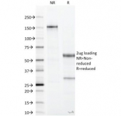 SDS-PAGE Analysis of Purified, BSA-Free Recombinant CA19-9 Antibody Rabbit Monoclonal (clone CA19.9/1390R). Confirmation of Integrity and Purity of the Antibody.