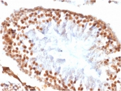 IHC testing of FFPE rat testis tissue with recombinant WT1 antibody (clone WT1/1434R). HIER: steam sections in pH 9 10mM Tris with 1mM EDTA for 10-20 min.