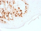 IHC testing of FFPE human skin with recombinant Melan-A antibody (clone MLANA/1761R). HIER: steam sections in pH 9 10mM Tris with 1mM EDTA for 10-20 min.