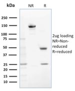 GST Mu 1 Antibody Purity Analysis by SDS-PAGE. Electrophoretic analysis of purified GST Mu 1 Antibody / Mu Class GST Antibody under non-reducing (NR) and reducing (R) conditions with 2 ug of antibody loaded per lane. The non-reduced antibody migrates predominantly at approximately 150 kDa, consistent with intact IgG, while reduction produces bands at approximately 50 kDa and 25 kDa, corresponding to the IgG heavy and light chains, respectively. This analysis confirms the purity and structural integrity of the purified GST Mu 1 Antibody.