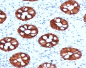 KRT20 Antibody Mouse Monoclonal CTKN20-1. Immunohistochemistry analysis of human colon tissue using mouse monoclonal KRT20 antibody (clone CTKN20-1). HRP-DAB brown chromogenic staining highlights cytoplasmic Keratin 20 / Cytokeratin 20 (KRT20) expression in epithelial cells lining colonic glandular crypt structures, while surrounding stromal cells remain largely negative. The staining pattern reflects the expected epithelial localization of this intermediate filament protein in gastrointestinal mucosa. Required HIER: boil tissue sections in 10 mM citrate buffer, pH 6, for 10-20 min followed by cooling at RT for 20 min.