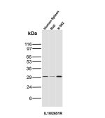 IL-10 Antibody IL10/2651R Detects IL-10 in Human Spleen and Cell Lines WB. Western blot analysis of human spleen, Raji B lymphocyte, and K-562 chronic myelogenous leukemia cell lysates using IL-10 Antibody (clone IL10/2651R) shows discrete major bands at approximately 29 kDa in all three samples, with the strongest signal in K-562 cells. Although monomeric IL-10 is approximately 18-20 kDa, IL-10 forms homodimers and higher apparent molecular-weight species in the approximately 30-35 kDa range have been reported. The consistent migration across the three lysates supports detection of IL-10 using this CSIF Antibody, with little visible nonspecific background.