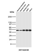 Western Blot Analysis of Human Intestine, Human Liver, Human Lung, A431, and HeLa lysates using KRT18 Antibody KRT18/2819R.