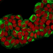 pS2 Antibody for IF. Immunofluorescence analysis of Trefoil factor 1 (TFF1) in PFA-fixed human MCF7 breast cancer cells using pS2 Antibody for IF clone TFF1/2133. Cells show cytoplasmic green fluorescence consistent with intracellular localization of the secreted TFF1 protein, while nuclei are counterstained with Reddot (red). The fluorescence pattern highlights epithelial tumor cells with cytoplasmic distribution typical of secretory pathway proteins and reflects the known estrogen-regulated expression of pS2 in MCF7 breast carcinoma cells.