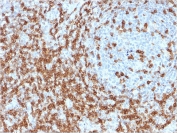 CD5 Antibody Clone CD5/2418. Immunohistochemistry analysis of CD5 antibody staining in FFPE human tonsil tissue using a microarray specificity validated antibody. Strong membranous staining is observed in T lymphocytes within interfollicular regions, with dense labeling surrounding germinal centers while follicular B cell areas remain largely negative. The staining pattern highlights normal tonsillar architecture and supports selective detection of CD5-positive T cell populations, consistent with microarray specificity validation. Heat-induced epitope retrieval was performed in 10 mM citrate buffer, pH 6, for 10-20 minutes followed by cooling at room temperature prior to antibody incubation.