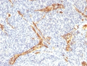 CD34 Antibody Tonsil IHC. Immunohistochemistry testing of FFPE human tonsil with recombinant CD34 antibody (clone HPCA1/2598R). Required HIER: boil tissue sections in 10mM Tris with 1mM EDTA, pH 9, for 10-20 min followed by cooling at RT for 20 min.