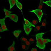 Aldose Reductase Antibody A549 IF. Immunofluorescence analysis of human A549 cells stained with Aldose reductase Antibody clone CPTC-AKR1B1-3 (green) and RedDot nuclear counterstain (red). Strong cytoplasmic fluorescence is observed throughout A549 cells, consistent with the expected intracellular localization of Aldose reductase / AKR1B1, an aldo-keto reductase family enzyme involved in polyol pathway metabolism, glucose-responsive signaling, and oxidative stress-associated cellular regulatory mechanisms.