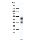Carboxypeptidase A1 Antibody Pancreas WB. Western blot analysis of Carboxypeptidase A1 / CPA1 in human pancreas tissue lysate using mouse monoclonal Carboxypeptidase A1 antibody, clone CPA1/2714. A band is detected at approximately 45 kDa, consistent with the predicted molecular weight of CPA1, with a secondary lower band that may represent proteolytic processing of this digestive enzyme, supporting its expected biochemical behavior in pancreatic tissue.