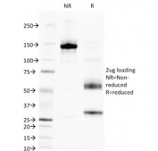 SDS-PAGE analysis of purified, BSA-free ALPL antibody (clone V17.1) as confirmation of integrity and purity.