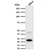 FTL Antibody HeLa WB. Western blot analysis of human HeLa cell lysate using FTL Antibody detects a strong band at approximately 20 kDa, consistent with ferritin light chain / FTL. A weaker higher molecular weight band may represent ferritin complex-associated or partially processed ferritin species. This ferritin complex assembly antibody supports detection of an intracellular ferritin subunit involved in iron sequestration, ferritin nanocage organization, and oxidative stress-responsive cellular regulation pathways.