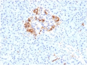 FTL Antibody Pancreas IHC. Immunohistochemistry analysis of FFPE human pancreas tissue stained with FTL Antibody demonstrates strong granular cytoplasmic HRP-DAB brown staining within clustered islet-associated endocrine cell populations, while surrounding exocrine pancreatic tissue shows comparatively lower background reactivity. The staining pattern is consistent with expression of ferritin light chain / FTL in metabolically active pancreatic cellular compartments involved in ferritin complex assembly and intracellular iron sequestration pathways. This ferritin complex assembly antibody highlights ferritin-associated oxidative stress-responsive cellular regulation within pancreatic tissue. HIER: boil tissue sections in pH 9 10mM Tris with 1mM EDTA for 20 min and allow to cool before testing.