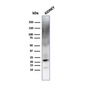 FTL Antibody Kidney WB. Western blot analysis of human kidney tissue lysate using FTL Antibody detects a strong band at approximately 20 kDa, consistent with ferritin light chain / FTL. Additional diffuse higher molecular weight signal may reflect ferritin complex-associated species or partially assembled ferritin protein complexes present in metabolically active renal tissue. This ferritin complex assembly antibody supports detection of intracellular ferritin-associated iron sequestration pathways and oxidative stress-responsive cellular regulation in kidney tissue.
